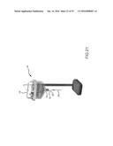 TISSUE PROCESSING APPARATUS WITH FLUID SUCTION FEATURES AND METHODS     RELATING TO COLLECTING AND PROCESSING HUMAN BIOLOGICAL MATERIAL diagram and image