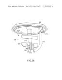 TISSUE PROCESSING APPARATUS WITH FLUID SUCTION FEATURES AND METHODS     RELATING TO COLLECTING AND PROCESSING HUMAN BIOLOGICAL MATERIAL diagram and image