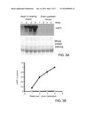 Autologous Tumor Lysate-loaded Dendritic Cell Vaccine for Treatment of     Liver Cancer diagram and image