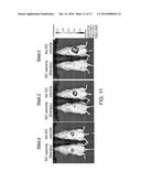 Autologous Tumor Lysate-loaded Dendritic Cell Vaccine for Treatment of     Liver Cancer diagram and image