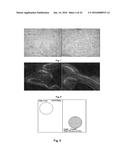 RESORBABLE MEMBRANE FOR GUIDED BONE REGENERATION diagram and image