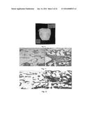 RESORBABLE MEMBRANE FOR GUIDED BONE REGENERATION diagram and image