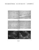 RESORBABLE MEMBRANE FOR GUIDED BONE REGENERATION diagram and image