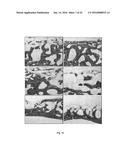 RESORBABLE MEMBRANE FOR GUIDED BONE REGENERATION diagram and image