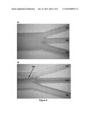 SYSTEM AND METHOD FOR BLOOD SEPARATION BY MICROFLUIDIC ACOUSTIC FOCUSING diagram and image