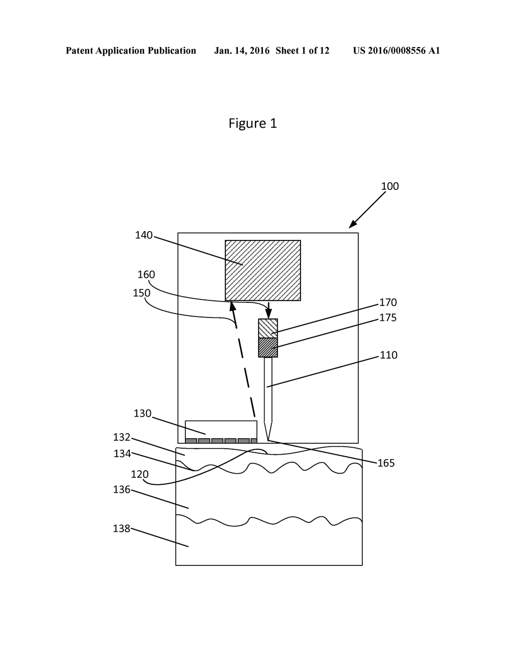 NEEDLE INSERTION SYSTEM AND METHOD FOR INSERTING A MOVABLE NEEDLE INTO A     VERTEBRATE SUBJECT - diagram, schematic, and image 02