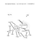 CATHETER ADD-ON AND METHODS OF PRODUCING AND USING SAME diagram and image