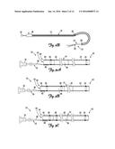 Boosting Catheter and Related Systems and Methods diagram and image