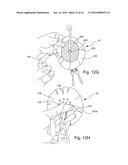 PERCUTANEOUS PORT GUARD DRESSING diagram and image