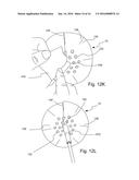 PERCUTANEOUS PORT GUARD DRESSING diagram and image