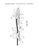 PERCUTANEOUS PORT GUARD DRESSING diagram and image