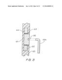 IMPLANT MAGNET SYSTEM diagram and image