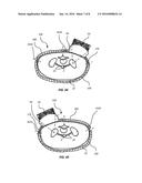 IMAGE-GUIDED FOCUSED ULTRASOUND ABLATION diagram and image