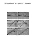 CATHETER-BASED ULTRASOUND TRANSDUCERS diagram and image