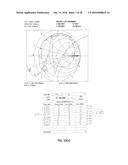 CATHETER-BASED ULTRASOUND TRANSDUCERS diagram and image