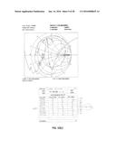 CATHETER-BASED ULTRASOUND TRANSDUCERS diagram and image