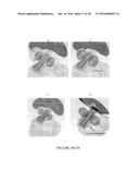 CATHETER-BASED ULTRASOUND TRANSDUCERS diagram and image