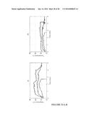 CATHETER-BASED ULTRASOUND TRANSDUCERS diagram and image