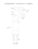 Segmented Mold Operator diagram and image