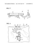 VARIABLE TRAJECTORY SIDE CURTAIN AIRBAGS diagram and image