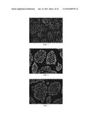 Anti-p40 Antibodies Systems and Methods diagram and image