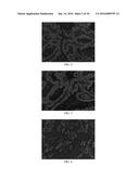 Anti-p40 Antibodies Systems and Methods diagram and image