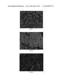 Anti-p40 Antibodies Systems and Methods diagram and image