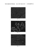 Anti-p40 Antibodies Systems and Methods diagram and image