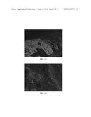 Anti-p40 Antibodies Systems and Methods diagram and image