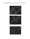 Anti-p40 Antibodies Systems and Methods diagram and image