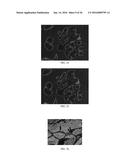 Anti-p40 Antibodies Systems and Methods diagram and image