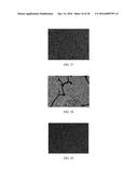 Anti-p40 Antibodies Systems and Methods diagram and image