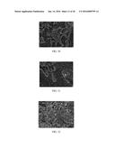 Anti-p40 Antibodies Systems and Methods diagram and image