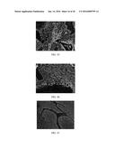 Anti-p40 Antibodies Systems and Methods diagram and image