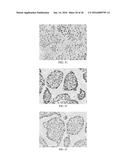 Anti-p40 Antibodies Systems and Methods diagram and image