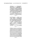 Anti-p40 Antibodies Systems and Methods diagram and image