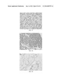 Anti-p40 Antibodies Systems and Methods diagram and image