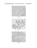 Anti-p40 Antibodies Systems and Methods diagram and image