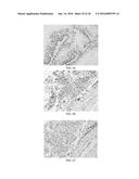 Anti-p40 Antibodies Systems and Methods diagram and image