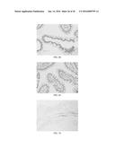 Anti-p40 Antibodies Systems and Methods diagram and image