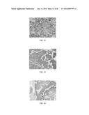 Anti-p40 Antibodies Systems and Methods diagram and image