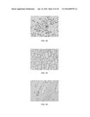 Anti-p40 Antibodies Systems and Methods diagram and image