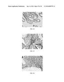 Anti-p40 Antibodies Systems and Methods diagram and image