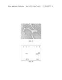 Anti-p40 Antibodies Systems and Methods diagram and image