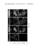 SPECIFIC DETECTION TOOL FOR MESENCHYMAL AND EPITHELIAL-MESENCHYMAL     TRANSFORMED CIRCULATING TUMOR CELLS diagram and image