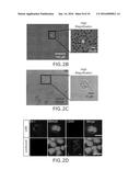 SPECIFIC DETECTION TOOL FOR MESENCHYMAL AND EPITHELIAL-MESENCHYMAL     TRANSFORMED CIRCULATING TUMOR CELLS diagram and image