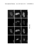 SPECIFIC DETECTION TOOL FOR MESENCHYMAL AND EPITHELIAL-MESENCHYMAL     TRANSFORMED CIRCULATING TUMOR CELLS diagram and image