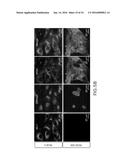 SPECIFIC DETECTION TOOL FOR MESENCHYMAL AND EPITHELIAL-MESENCHYMAL     TRANSFORMED CIRCULATING TUMOR CELLS diagram and image