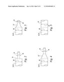 Intake Manifold Overpressure Compensation For Internal Combustion Engines diagram and image