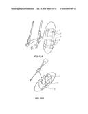 SPORT EQUIPMENT diagram and image